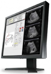 Monitor EIZO RadiForce MX194