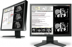 Monitor EIZO RadiForce MX194