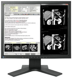 Monitor EIZO RadiForce MX194
